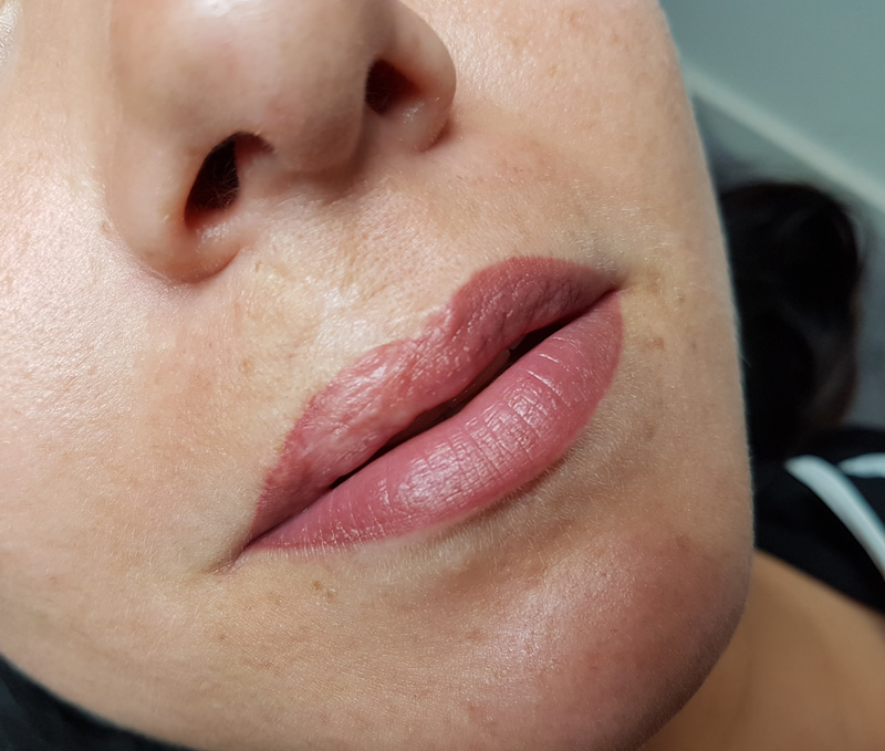 Full Lips Permanent Make-up genezen