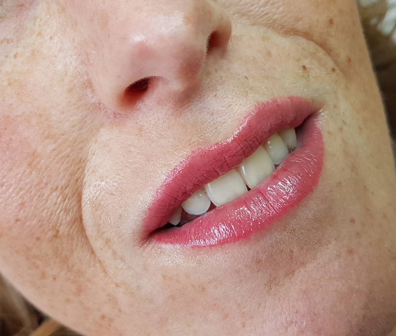 Full Lips Permanent Make-up genezen